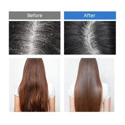 5 Probiotics Perfect Volume Shampoo Шампунь для объема волос с пробиотиками