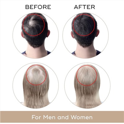 USA Dekohair Hair Regrowth Serum - Stops Hair Thinning, Promotes Growth, Increases Root Volume