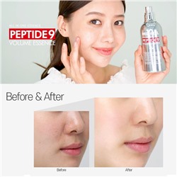 Peptide 9 Volume Essence, Кислородная эссенция с пептидным комплексом