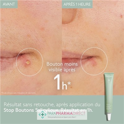 Caudalie Vinopure - Stop Bouton Salicylique 15ml