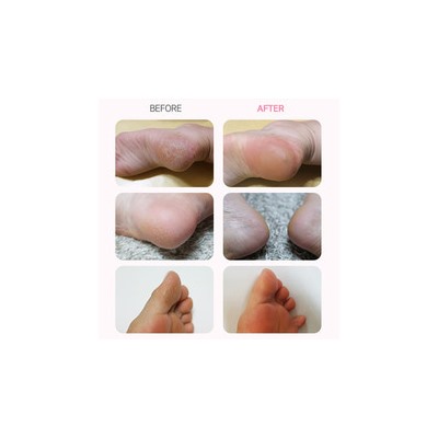 Rorobee Soft Peel Off Foot Pack Пилинг-носочки