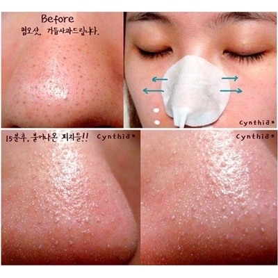 Pore Control Blackhead Off Sheet 	Салфетки для удаления черных точек и камедонов