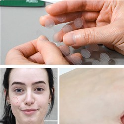 All Care Recovery Cica-Aid, Антибактериальные наклейки против прыщей