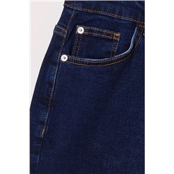 Açık Mavi Yüksek Bel Esnek Skinny Denim Şort & Bermuda TBBSS22AP0008