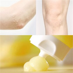 Pineapple Mild Peeling Gel, Мягкий пилинг-скатка с экстрактом ананаса