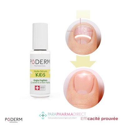 Poderm Huile Sérum Kids Ongles Abîmés 8 ml