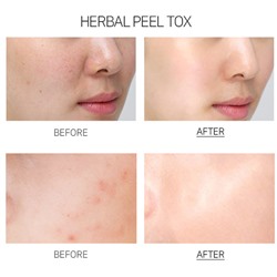 Herbal Peel Tox, Крем-маска с экстрактом Центеллы Азиатской