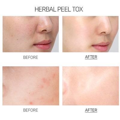 Herbal Peel Tox, Крем-маска с экстрактом Центеллы Азиатской