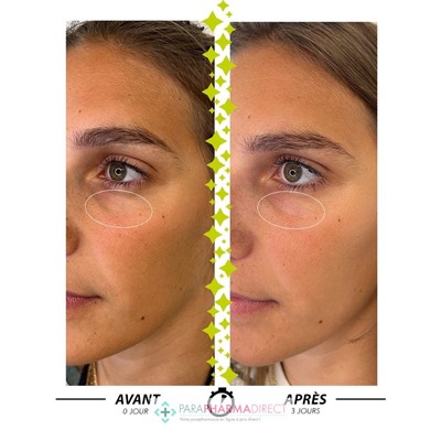 Garancia Larmes de Fantôme Paupières & Contour des Yeux Anti Cernes 10ml + 1 Diabolique Tomate Crème d'Eau 6ml OFFERTE