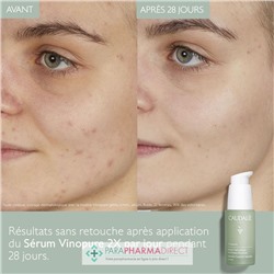 Caudalie Vinopure - Sérum Salicylique Anti-Imperfections 30ml
