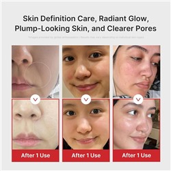 medicube Age-R Booster Pro Pink | 6-in-1 Real Glass Glow Beauty Massager | Looking Glass Skin | Korean Skin Care