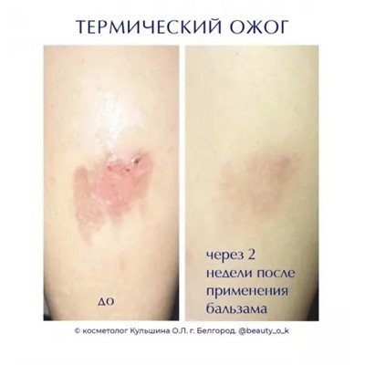 Реген-бальзам с Дигидрокверцетином 200 мл