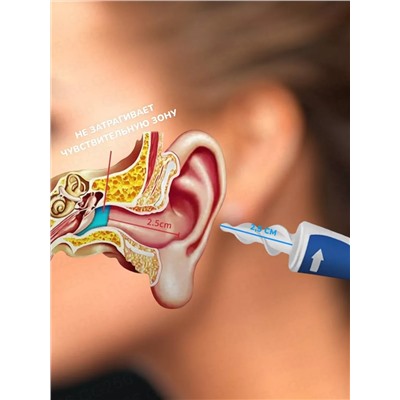 Набор для чистки ушей 60248