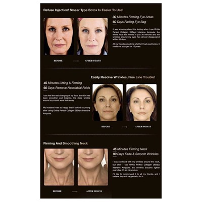 Тканевая маска с коллагеном COREANA - Orthia Perfect Collagen 28 Days Intensive Ampoule whitening Mask - 10 шт